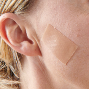 Products: Myscar Face silicone strips - large 7.5cm - 4 month supply Myscar