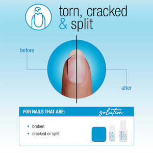 Nail Tek: Nail Tek Nail Repair For Torn, Cracked Or Split Nails 2pc Kit