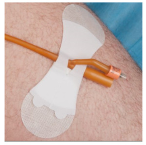 Urinary Catheter Care: Grip Lok Large non-sterile