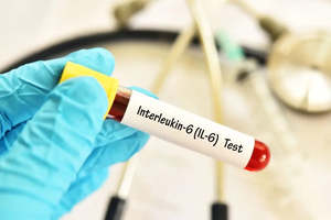 Testing: IL-6 Testing - Inflammation