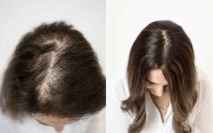 Haliee 3 x 5 Hum,an Hair Topper