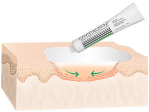 Products: Crystaderm First Aid Cream 15g St Lukes Pharmacy