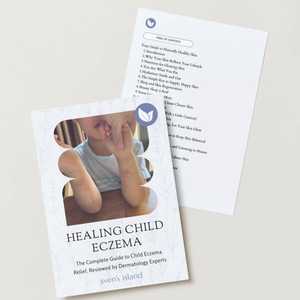 Eczema: The Child Eczema Handbook: A Holistic Guide to Child Eczema Relief Printable