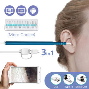 Computer: Ear Cleaning Endoscope Spoon Diagnostic Tool Ear Cleaner 3 in 1