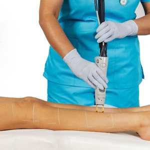 Products: Laser for Pigmentation – Legs – Half