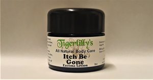 Ailment: Itch Be Gone – Eczema Lotion