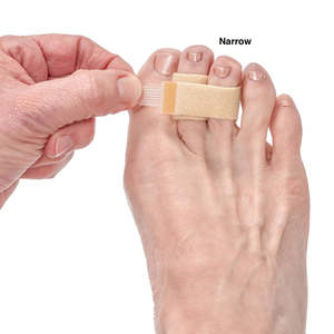 Toe Splinting: 3PP TOE LOOPS