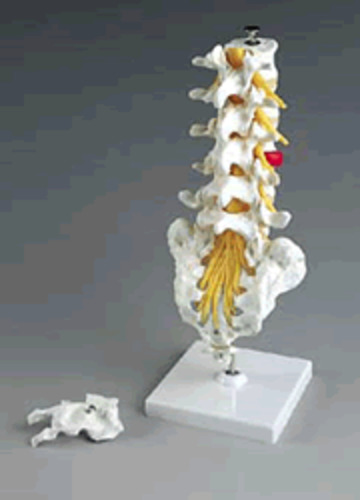 Anatomical Models: MODEL FLEXIBLE LUMBAR VERTEBRAL COLUMN WITH HERNIATED DISC