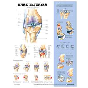 CHART KNEE INJURIES