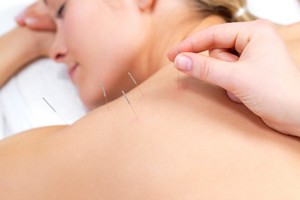 Chinese Therapeutic Massage + Acupuncture