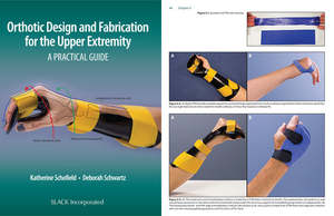 Splinting Guides Books: Orthotic Design and Fabrication for the Upper Extremity: A Practical Guide